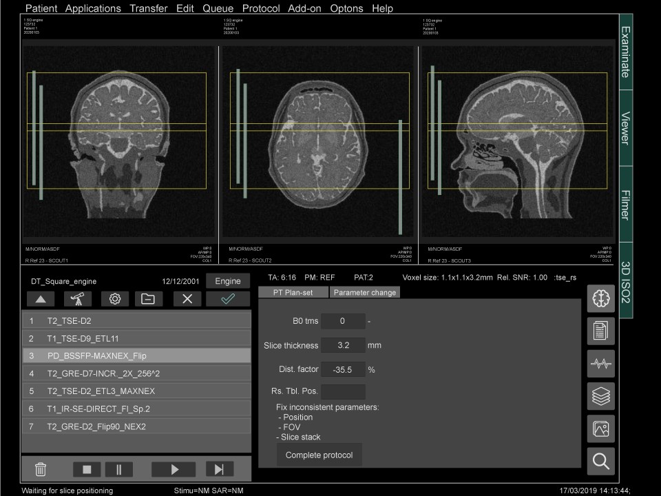 Medical industry MRI software